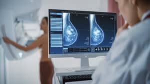 Mammogram in McKinney, TX, shows dense breasts